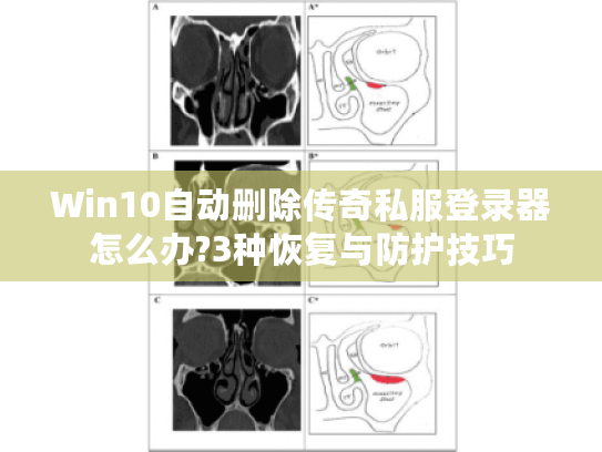 Win10自动删除传奇私服登录器怎么办?3种恢复与防护技巧