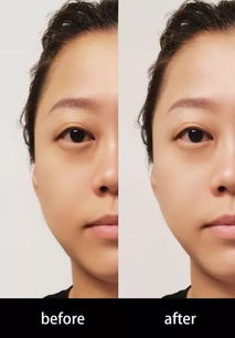 《义眼职业速成攻略：揭秘快速致富捷径》