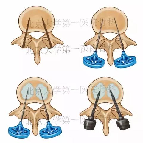 手游攻略：遇见手游高效刷强化材料技巧揭秘