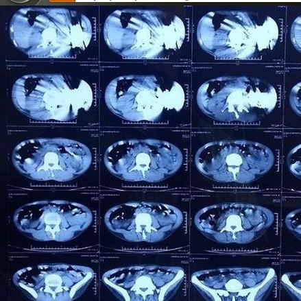 肿瘤医生第4关通关攻略：图文详解+独家技巧，轻松过关秘籍！