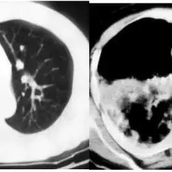独家揭秘：快速掌握空洞骑士丝之歌念珠炮获取技巧攻略